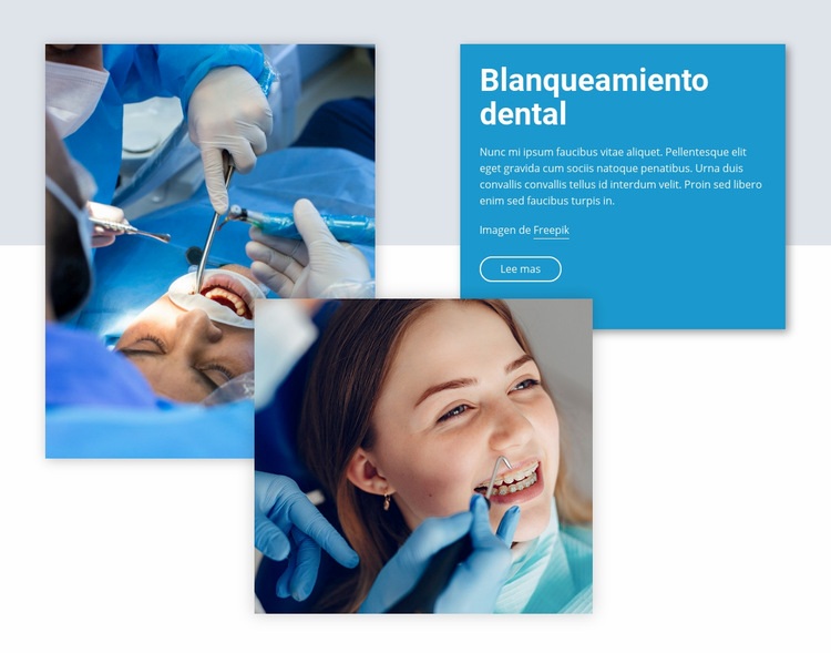 Blanqueamiento dental profesional Plantillas de creación de sitios web