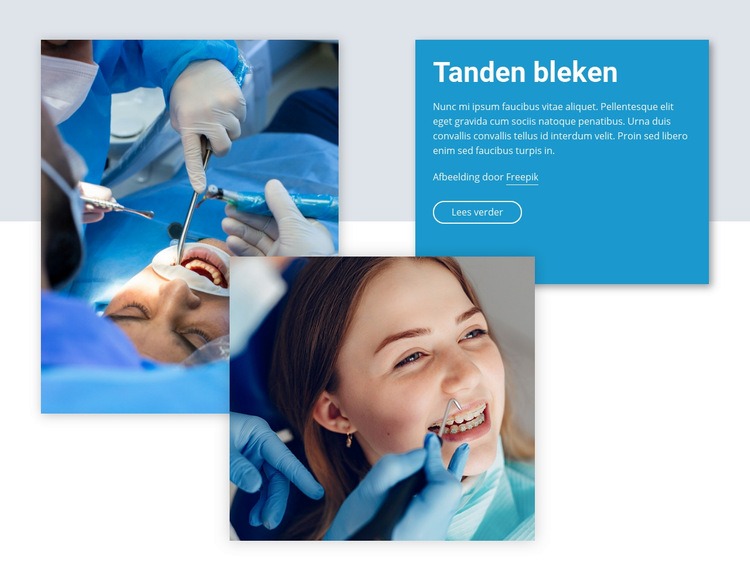 Professioneel bleken van tanden Website mockup