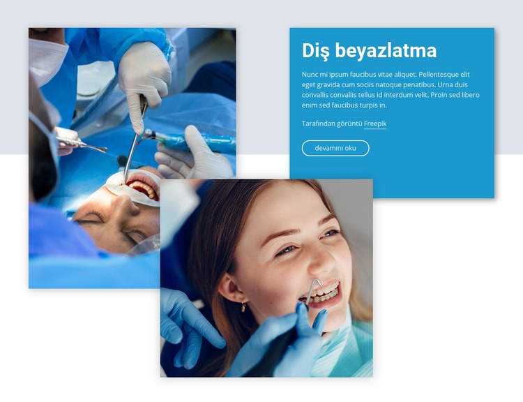 Profesyonel diş beyazlatma Web Sitesi Mockup'ı